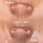 예손스킨앤바디