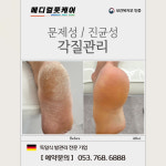 독일식문제성손발관리전문점푸스플레게장연자 | 내성발톱 무좀발톱 메디컬풋케어 & 푸스플레게