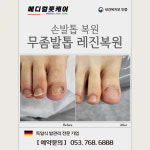 독일식문제성손발관리전문점푸스플레게장연자 | 내성발톱 무좀발톱 메디컬풋케어 & 푸스플레게