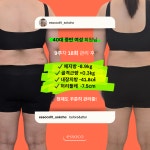 에소코핏 속초점