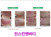 진스킨앤바디