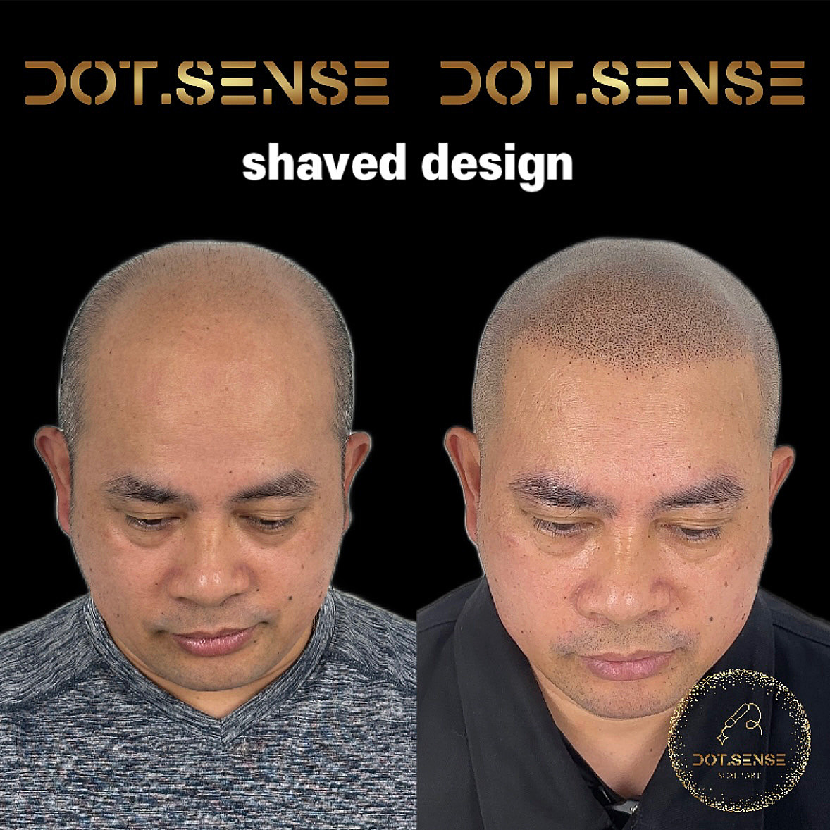 공릉로 두피문신