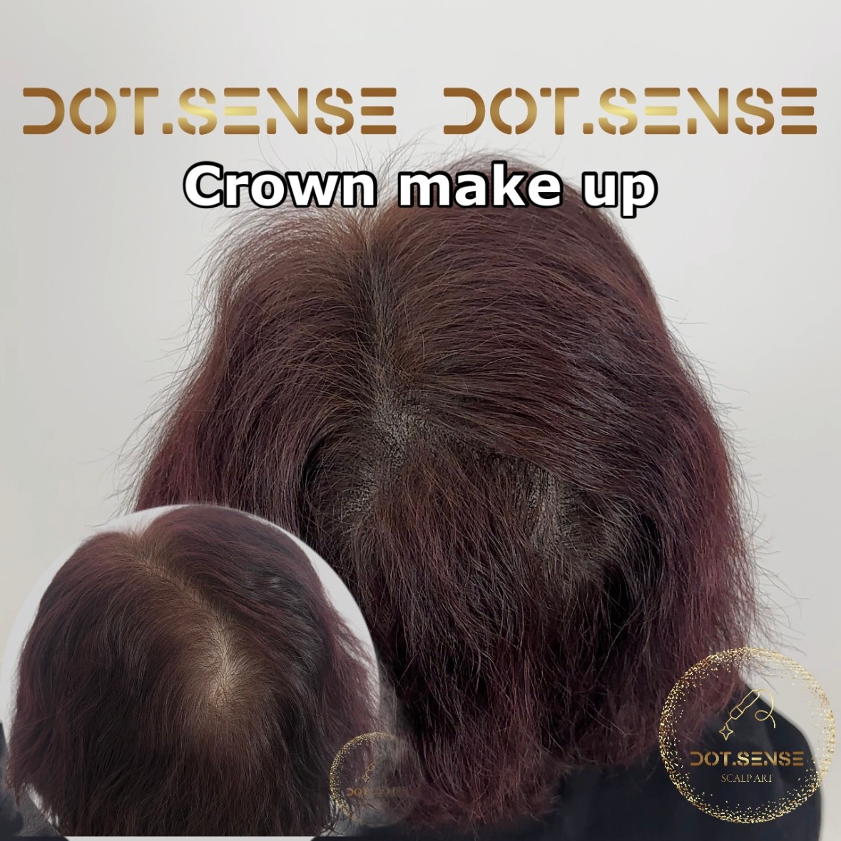 노원구 두피문신