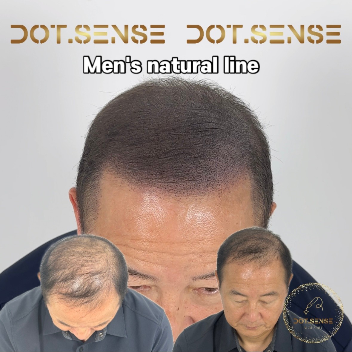 서울 노원 노원두피문신