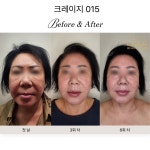 퍼플문