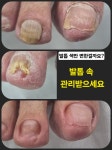 네일젤이뻐