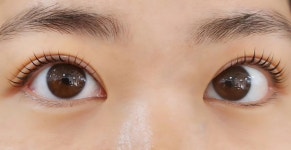 예쁨담다스킨케어