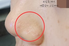 예쁨담다스킨케어