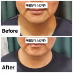 예쁨담다스킨케어