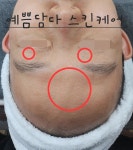 예쁨담다스킨케어