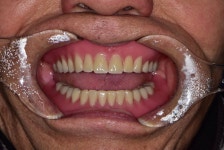 한길치과기공소