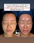 에그뮤즈 스킨스칼프 수원직영점