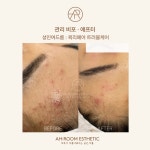 아룸에스테틱 왕십리센트라스점