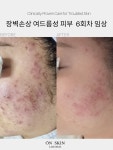 온스킨라운지 안양범계점