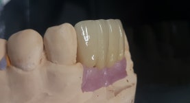 이튼치과기공소