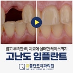 큐플란트치과의원