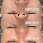 J에스테틱