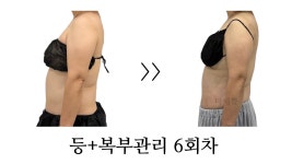 더예쁨