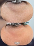 수원왁싱천사뷰티