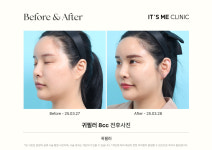 잇츠미성형외과의원