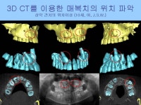 웃는E치과교정과치과의원