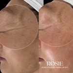 로지에스떼 서초 잠원본점