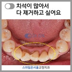 스마일온서울 치과교정과 치과의원