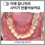 스마일온서울 치과교정과 치과의원