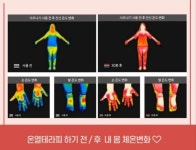 미라클뷰티 온열테라피