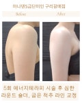 아나덴 슈가링왁싱 구리갈매점