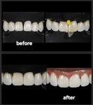 굿모닝치과의원