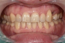 지르아트치과기공소