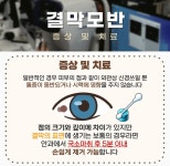 주엽성모안과의원