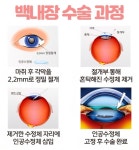 주엽성모안과의원