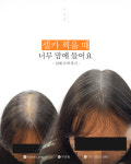 생명나무두피프렌즈 | 두피움SMP