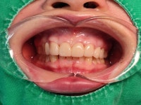 미류치과기공소