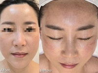 휴에스테틱 진주초전점