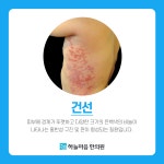 하늘마음한의원 강동천호