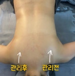 에블바디 문제성피부 의정부민락점