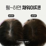 옻안타는천염염색&두피 | 더 유안 눈썹,두피,왁싱