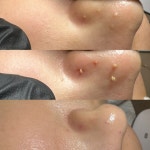 예쁠래 에스테틱