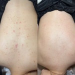 예쁠래 에스테틱