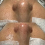 예쁠래 에스테틱