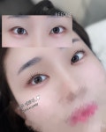 인셀덤해솜뷰티점 | 아이솜뷰티