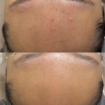 예쁠래 에스테틱