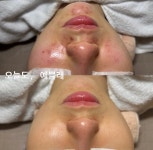 예쁠래 에스테틱