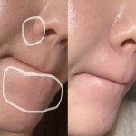 예쁠래 에스테틱