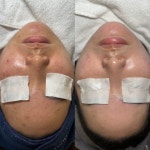 예쁠래 에스테틱