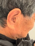 모아히어링 보청기 송파센터
