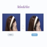 뷰티온의원 평택고덕점